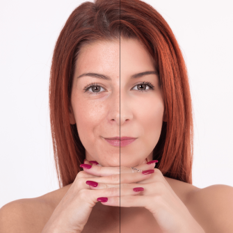 Brown Photo Classy and Refined Laser Hair Removal Sale Facebook Post Brown Photo Classy and Refined Laser Hair Removal Sale Facebook Post